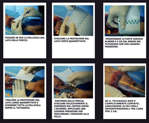 DERMALIZE FILM, 5pcs